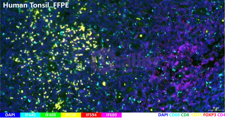 FFPE of Human Tissue 11