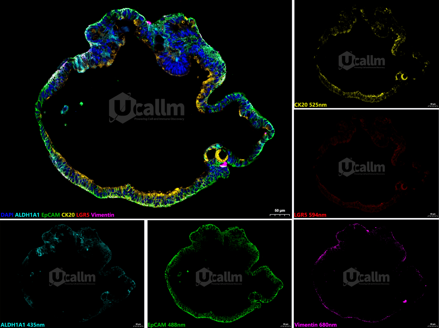 Figure1 5‑Plex 6 color mIHC staining images of human colorectal cancer organoids