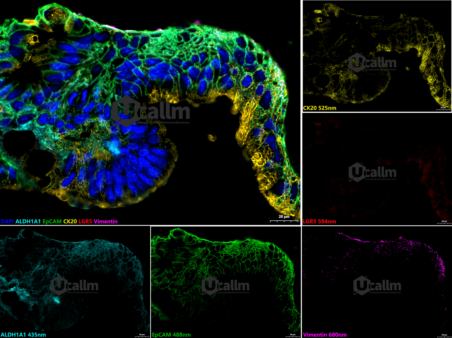 Figure2 High‑magnification 5‑Plex 6 color mIHC staining images
