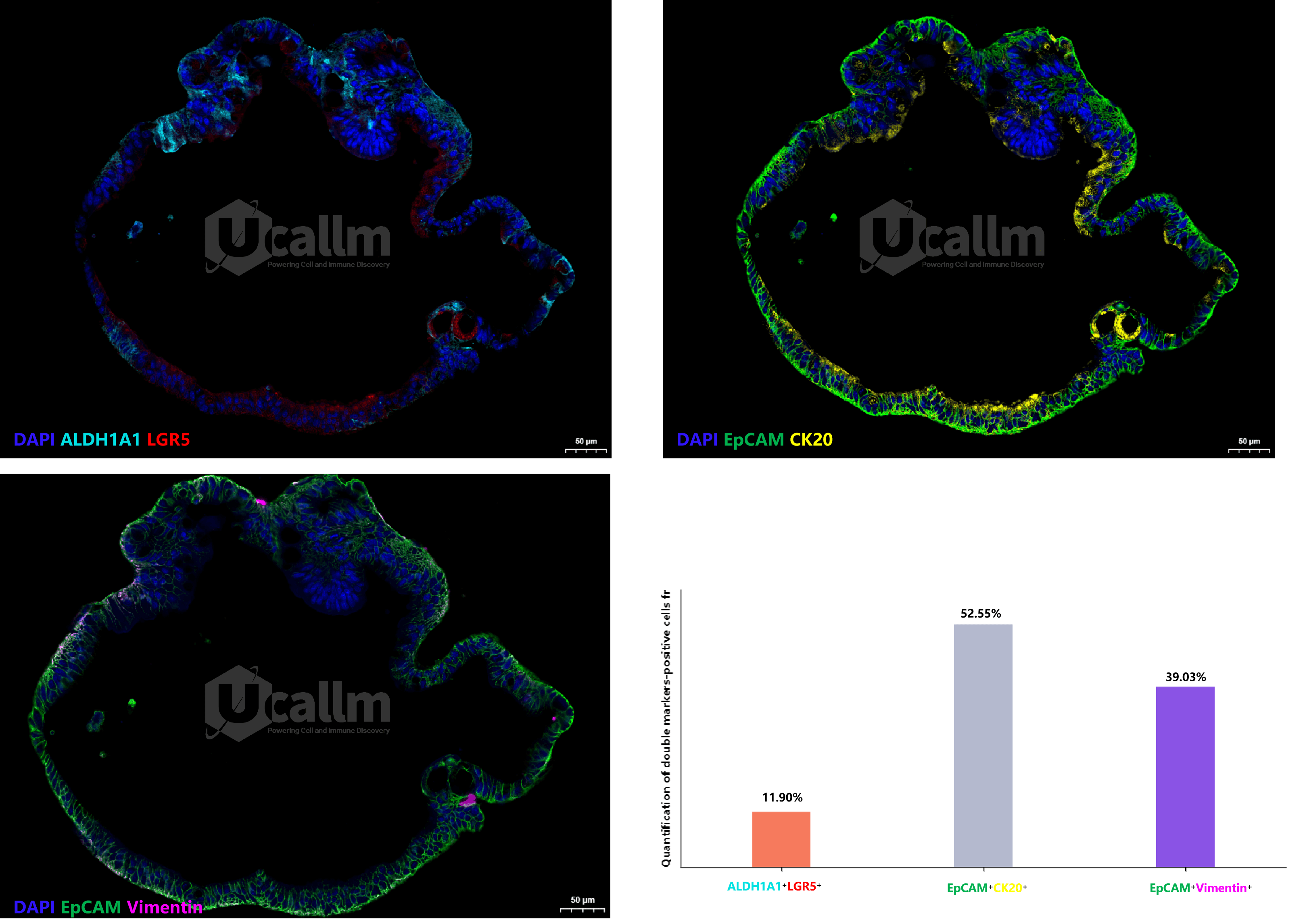 Figure4 Quantification of double markers‑positive cells fractions